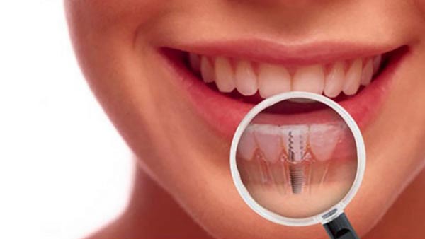 Cosmetic Dental in Chandigarh