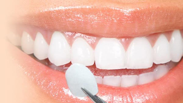 Cosmetic Dental in Chandigarh