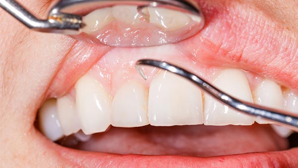 Oral Surgery - Dentists